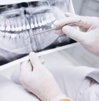 CONE BEAM: El estándar de oro de la imagen seccional 3D en odontoestomatología