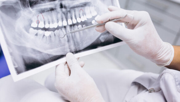 CONE BEAM: El estándar de oro de la imagen seccional 3D en odontoestomatología