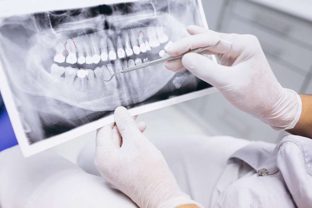 CONE BEAM: El estándar de oro de la imagen seccional 3D en odontoestomatología